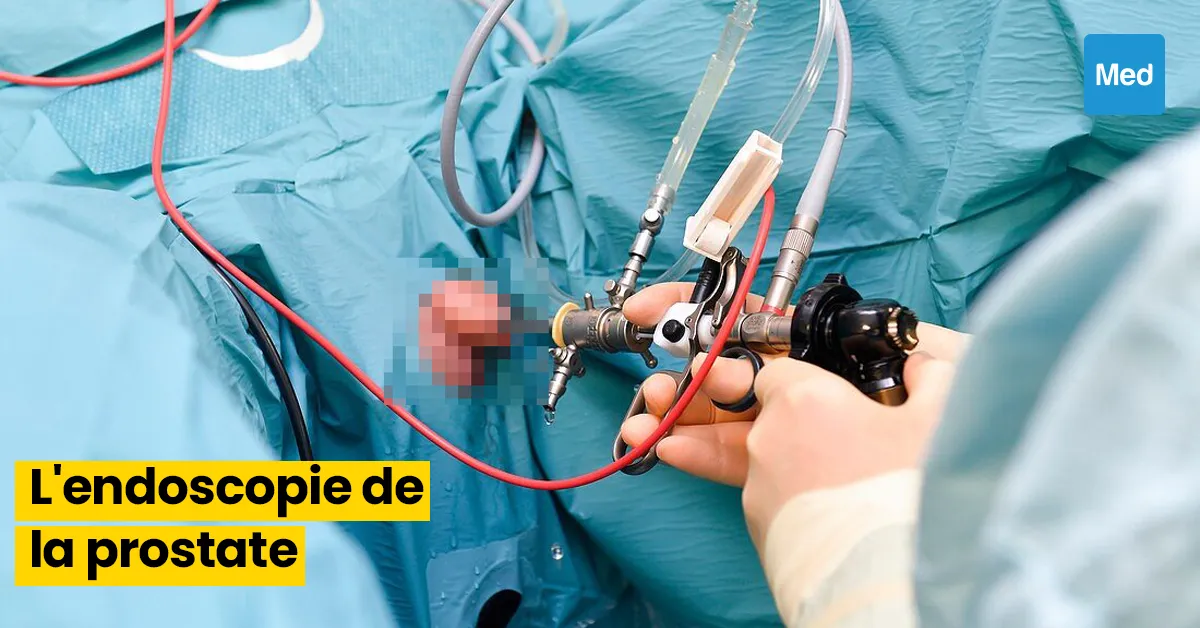 Comprendre l'Endoscopie de la Prostate